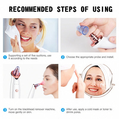 Facial Blackhead And Acne Electric Remover - Jscomfortzstore